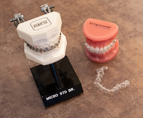 咬合異常に対する矯正歯科治療、 顎変形症に対する矯正歯科治療は 保険が適用されます